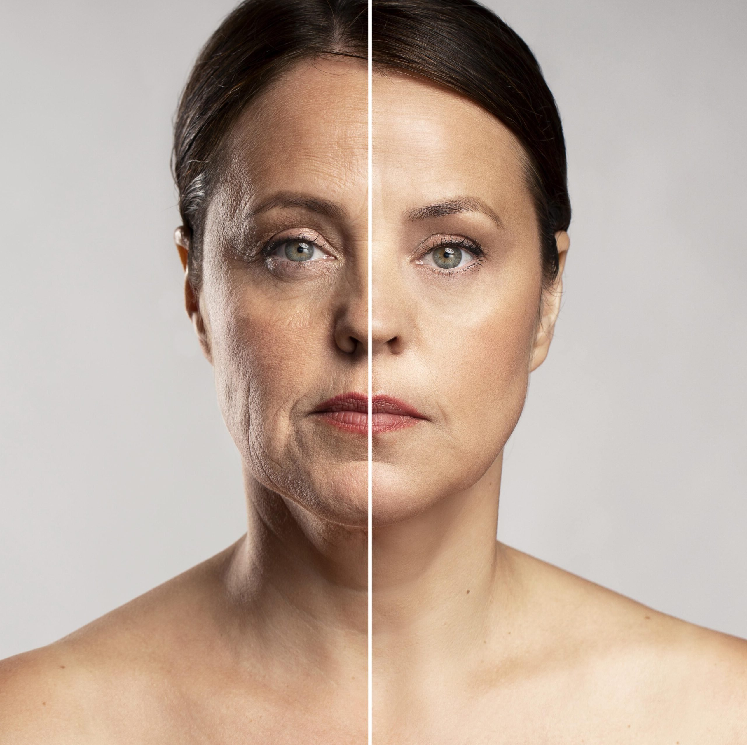 Comparação antes e depois do protocolo de exercícios faciais — resultado ilustrativo baseado em relatos de alunas reais